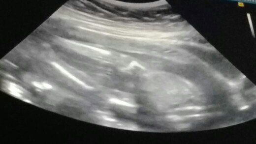 baby boy or girl??