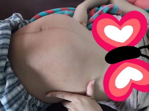 ตัวน้อยโก่งตัว