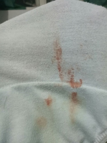 Blood after Sex, @ 35 Weeks