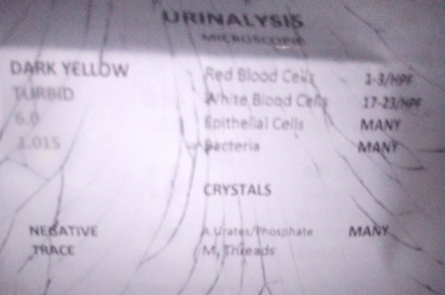 Lab test result 🥺🥺