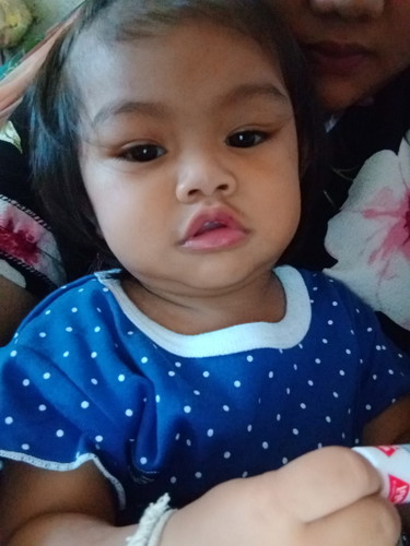 ป่วย