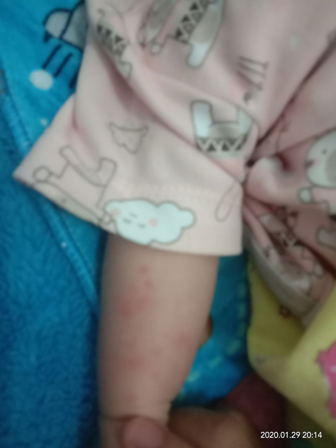 Bintik Merah Seperti Jerawat Kecil