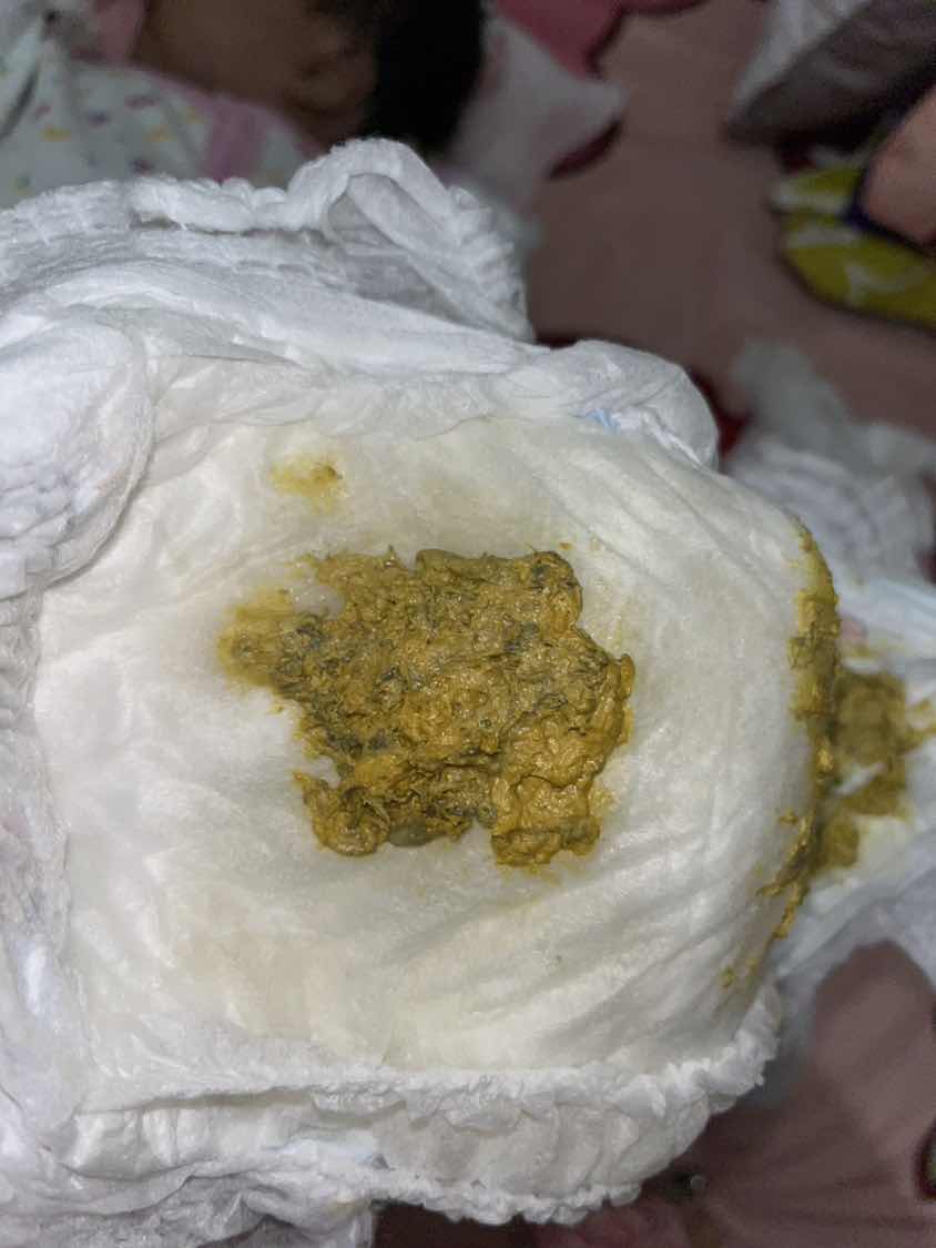 Bund mau tanya pup bayi sufor