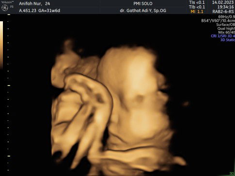 Arifah Nur Fitria profile icon