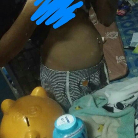 คนท้อง17 week