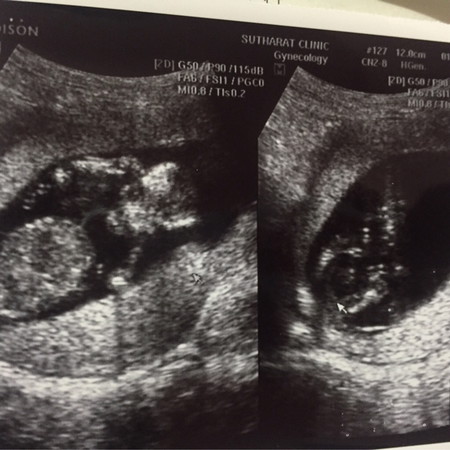 14Weekจ้าาาา