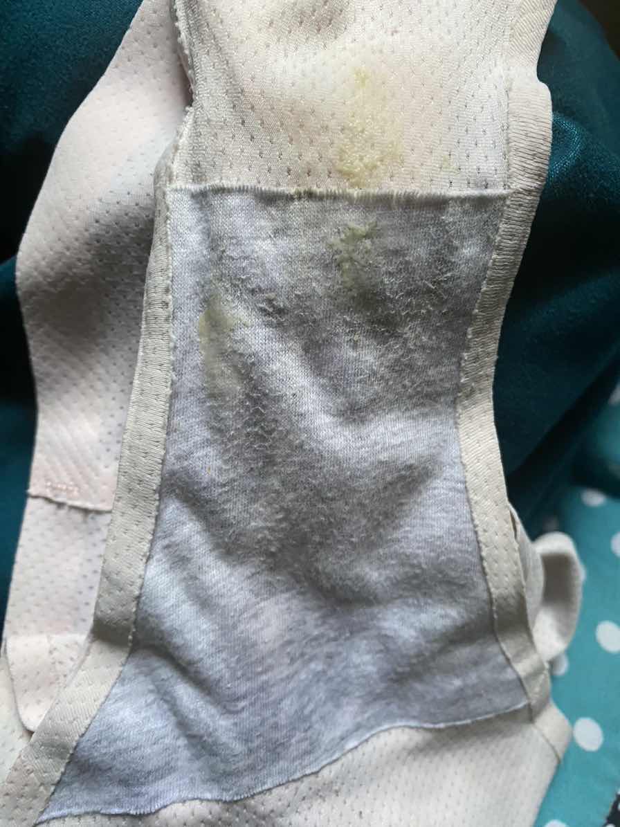 Keputihan usia 27 weeks