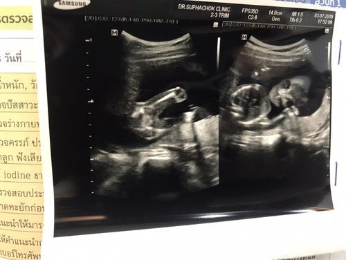 ได้ลูกสาววววว