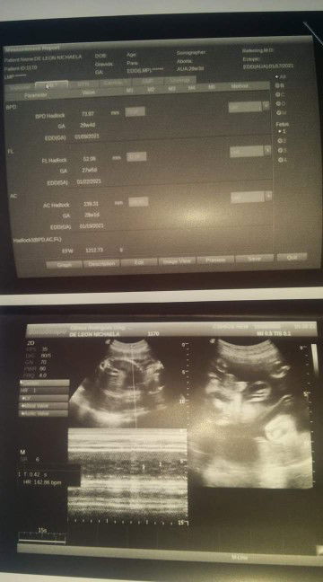 Nichaela De Leon profile icon