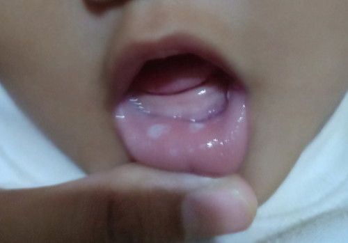 8 bulan