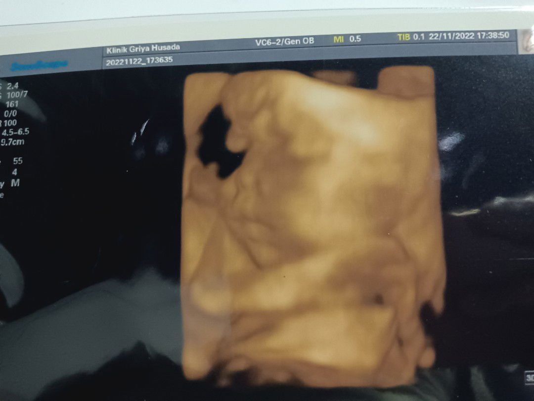 Ayu Wulandari profile icon