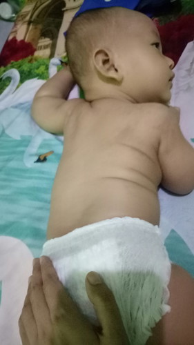 Kulit alergi