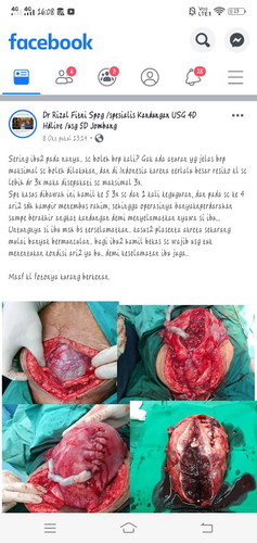 For Your Information ya Bu Ibu