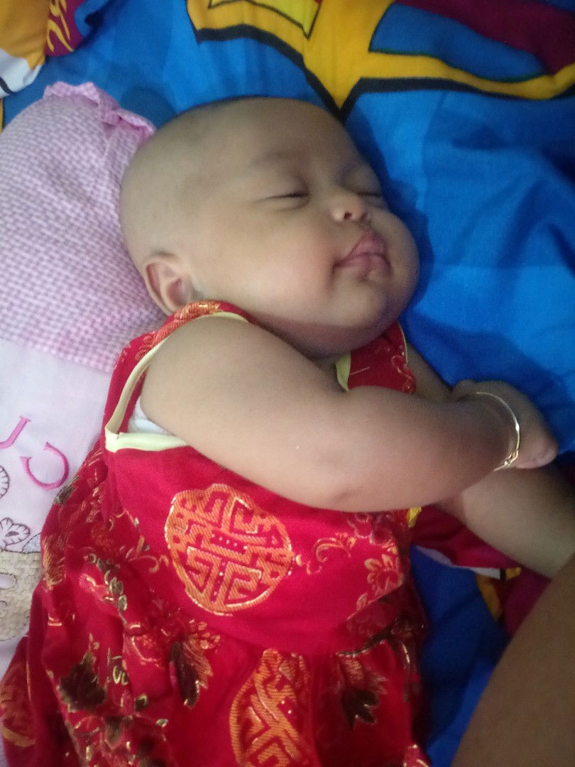 TELINGA KELUAR CAIRAN