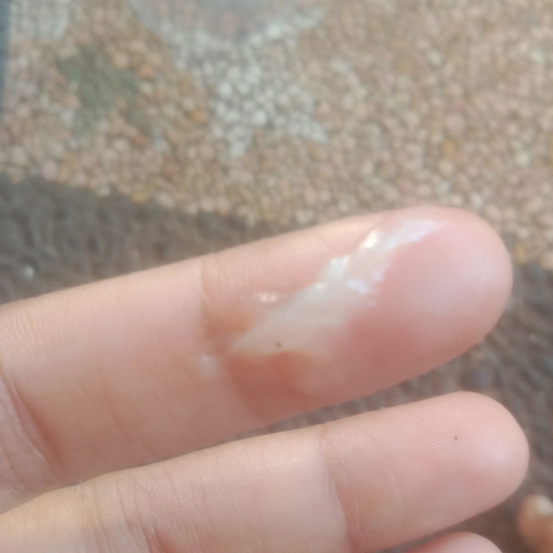 Maaf jorok, ini keputihan apa bukan?