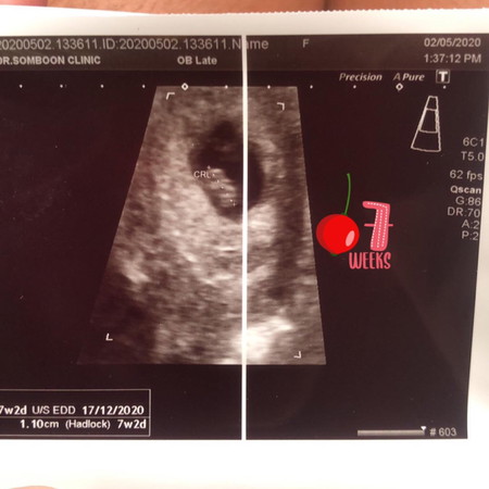 7วีคกับ2วันแล้ว
