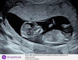 Phuttharaksa Chanchol profile icon