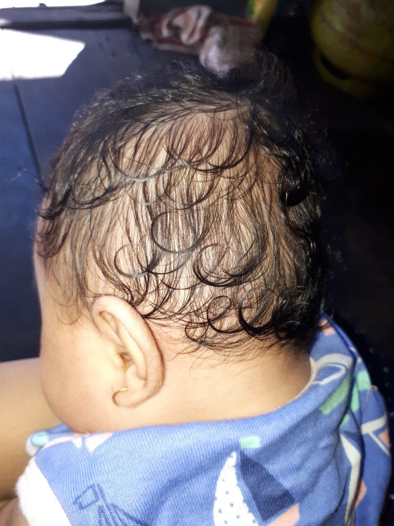 kesindiran waktu hamil