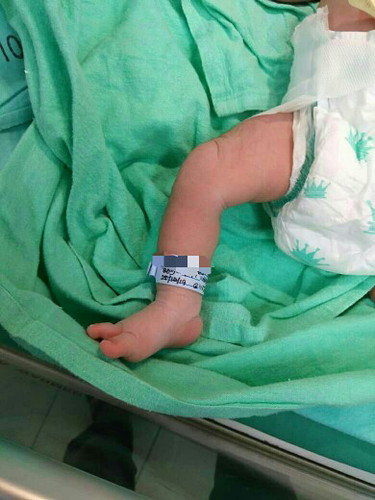 Bersalin ibu gdm + insulin