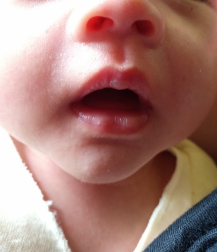 bibir bayi
