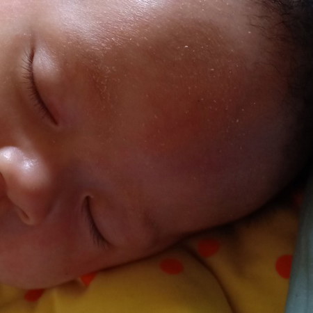 kulit muka bayi