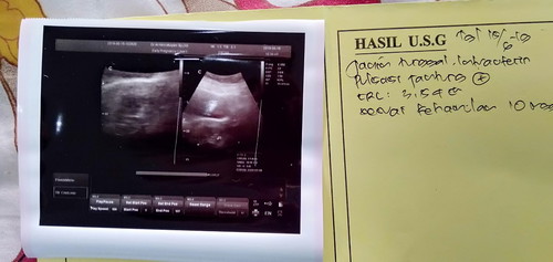 perbedaan usia janin