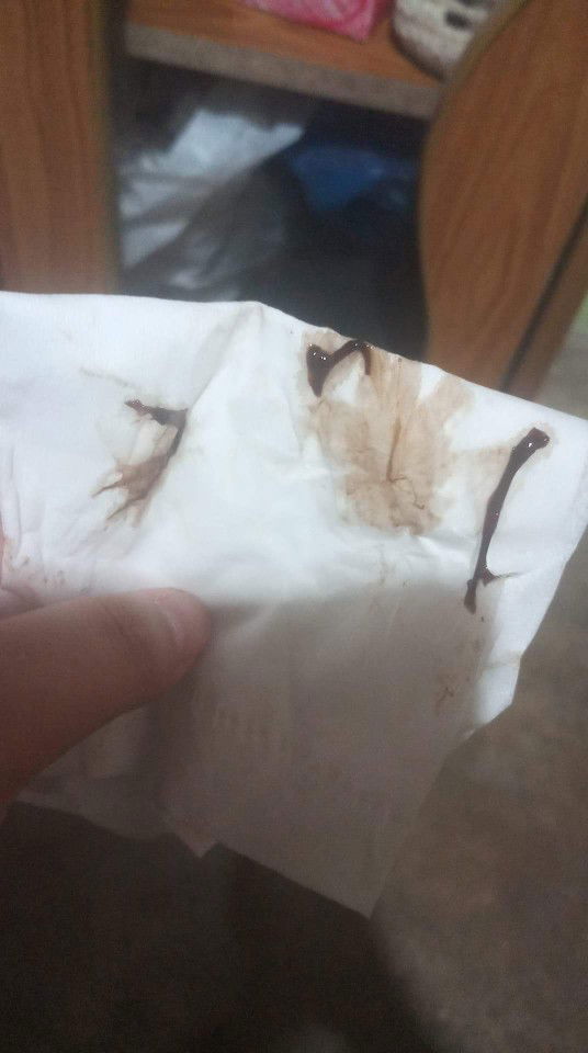 มูกเมือก