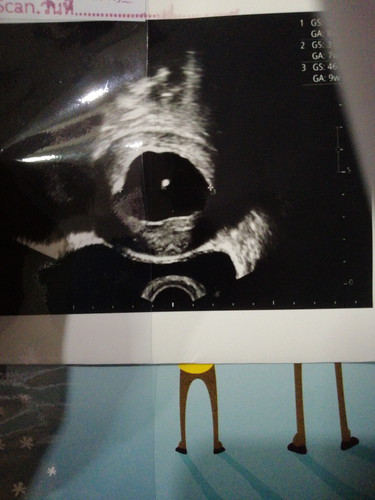 ตั้งครรภ์