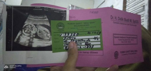 hsil usg temen usia 4 bulan