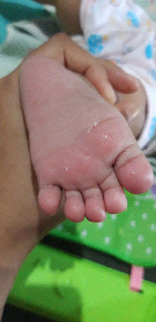 kaki keringat dingim