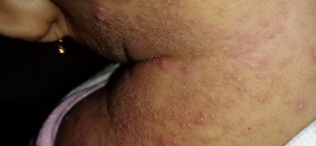 awalnya biang keringat