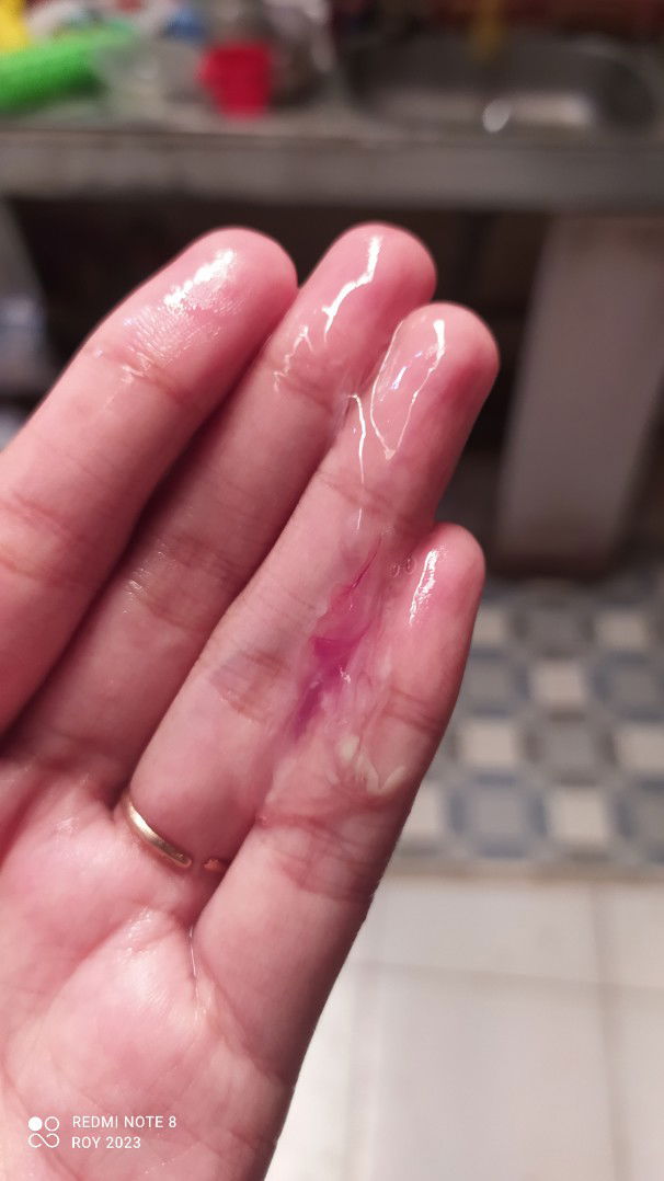 Mohon do'anya buibuu 🙏🏻