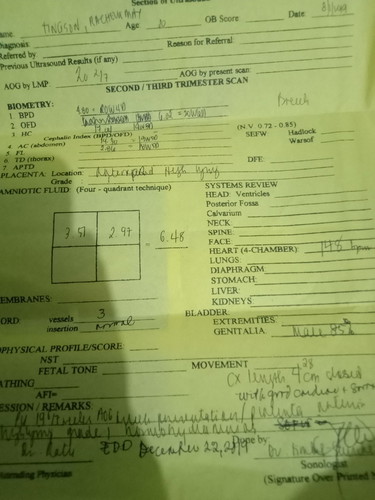 SANA MAY MAKA PANSIN NITO