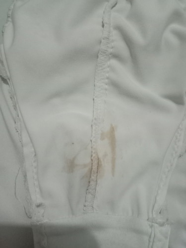 SPOTTING OR DISCHARGE