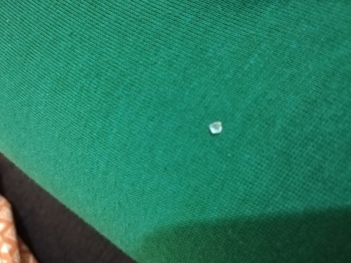 soft crystal in urine/diaper