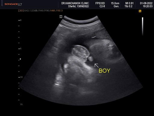 Phatcharapha Saikham profile icon