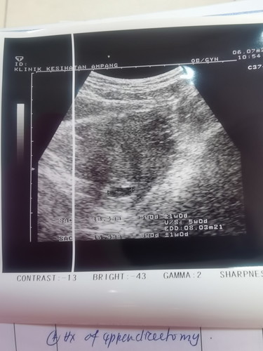 BILA SCAN BABY KURANG BESAR DARI DUE