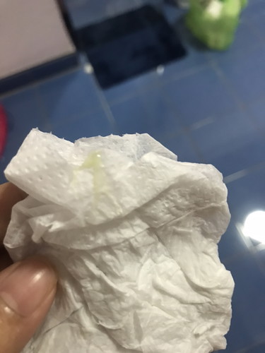 แบบนี้ใช่มูกก่อนคลอดมั้ยคะ?