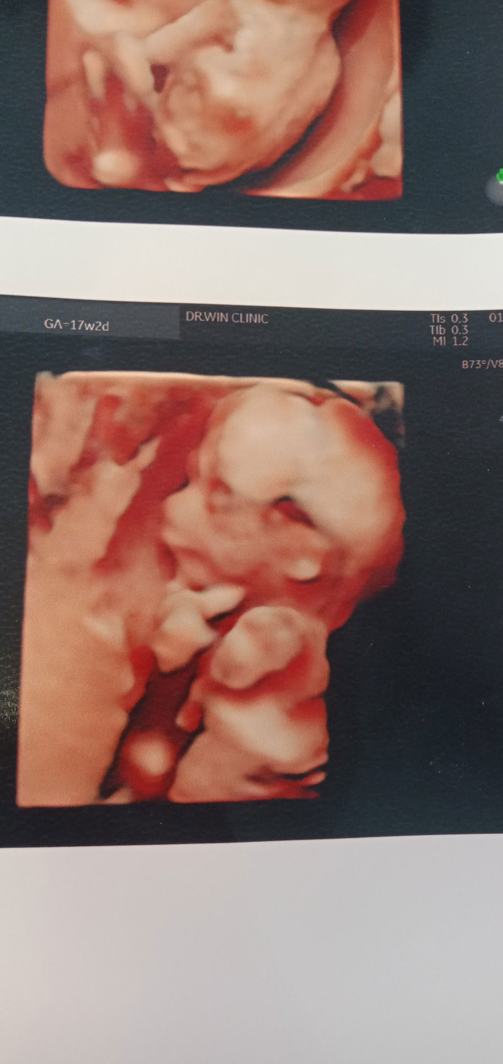 Chanatinard Fern profile icon