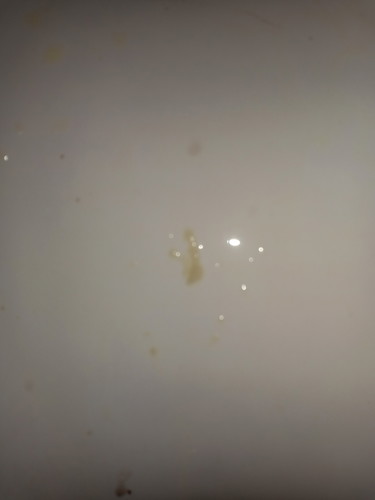 28+5week ตกขาว