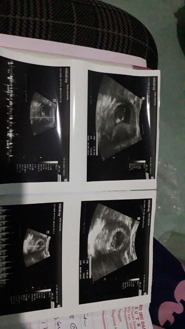 Eli pratama profile icon