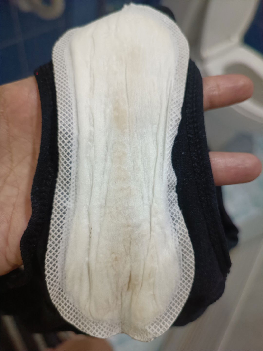 ขออนุญาตสอบถามหน่อยค่ะ ตกขาวแบบนี้ผิดปกติไหม เป็นแบบนี้เกือบทุกวันเลยค่ะ ท้องแรกแม่กังวล🥹🥹🥹