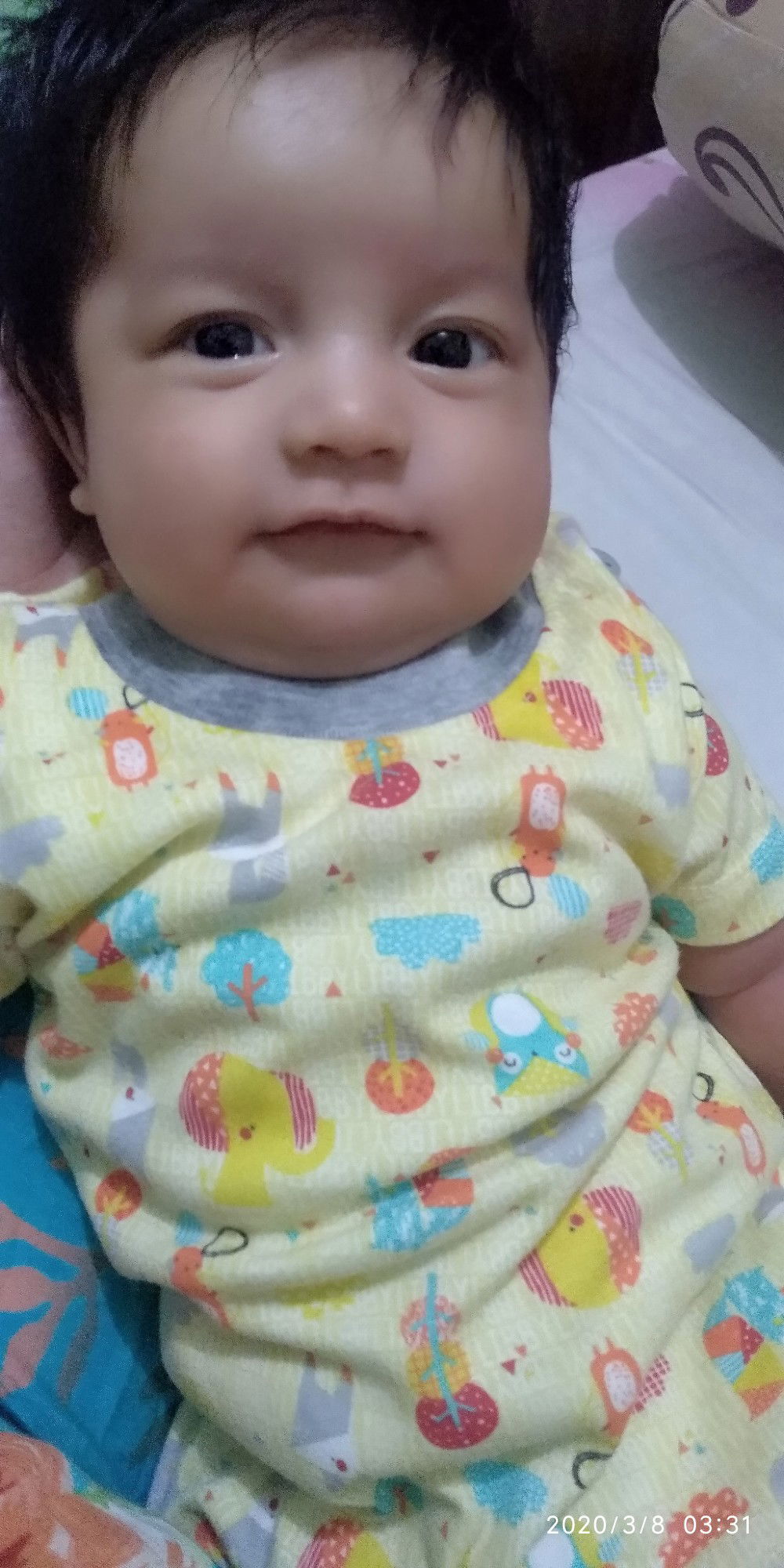 dibawah mata bengkak