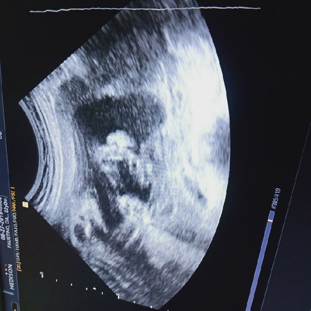 its baby girl