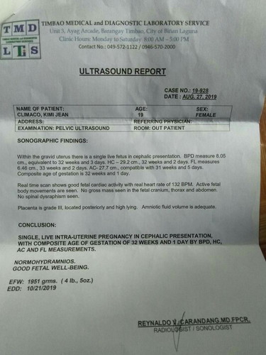 PA EXPLAIN NAMAN PO HEHE.