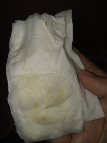 yellow discharge