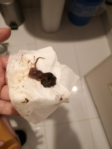 Mucus Plug?