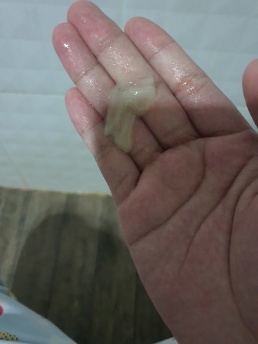 ปรึกษาคะ อายุครรถ์38+6