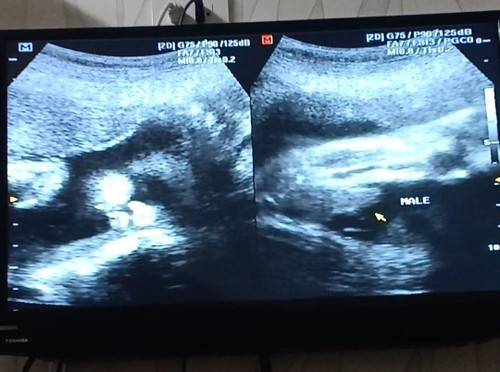 น้องอชิ 31 week 3 day