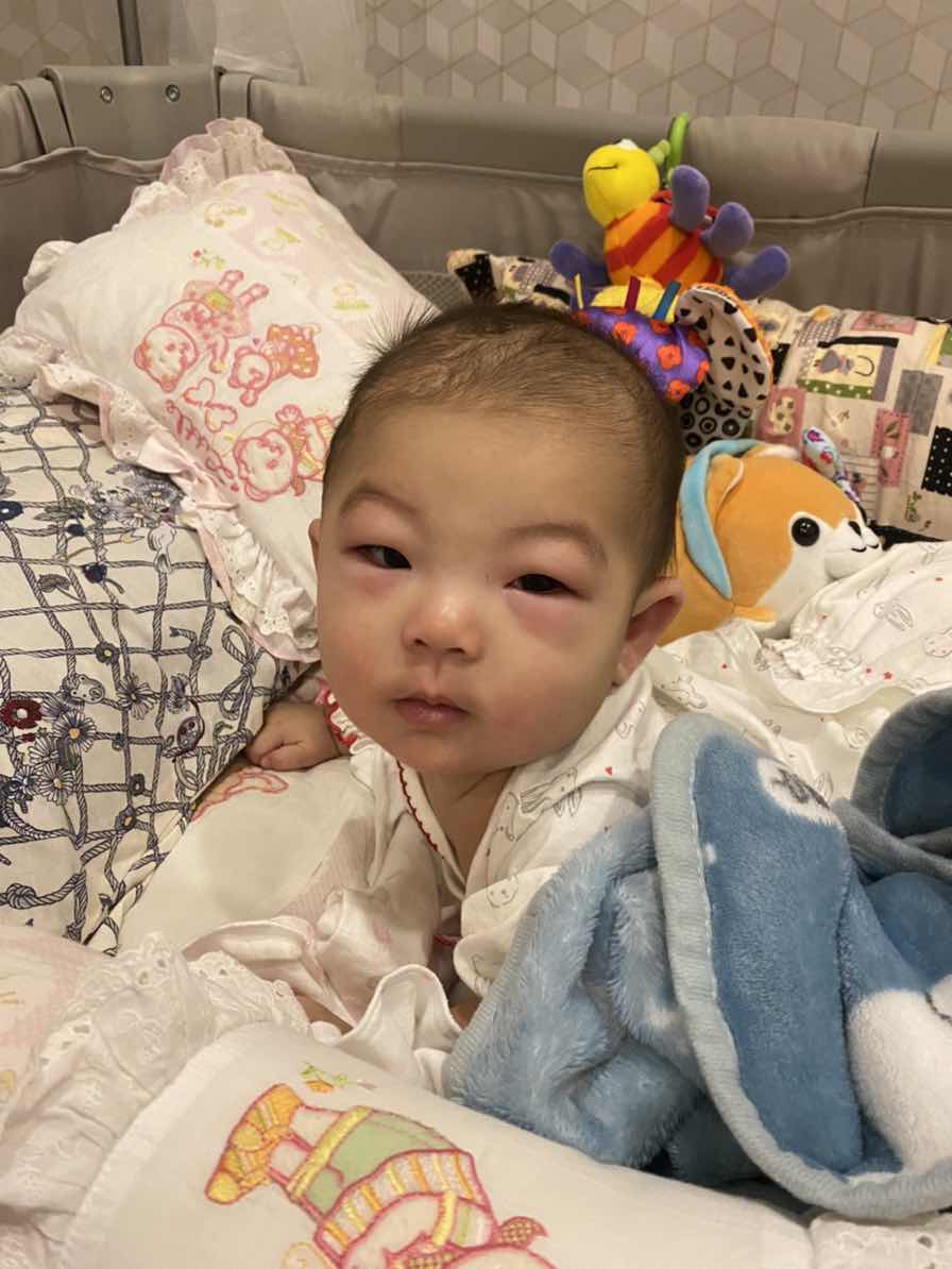 แพ้แป้งสาลี